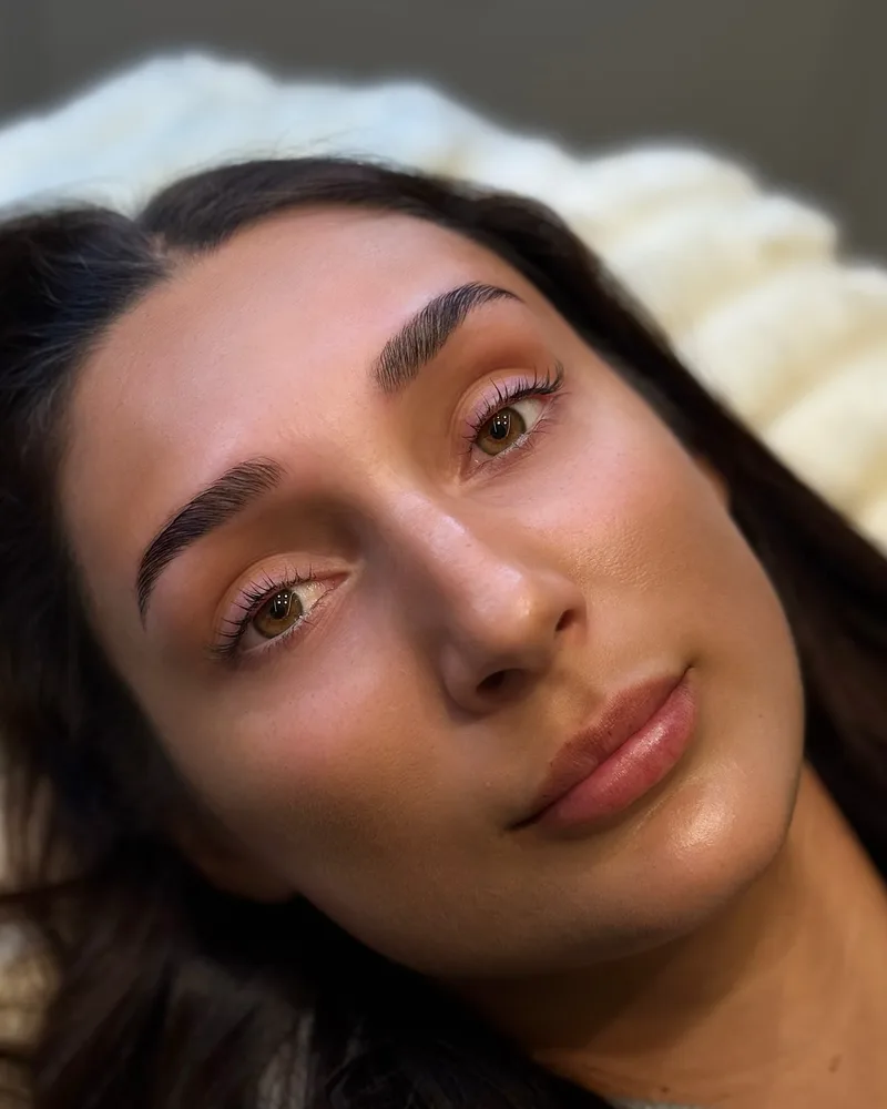 Resultat efter browlift